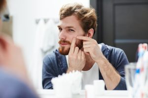 Dez mitos e verdades sobre a acne. Tire suas dúvidas!